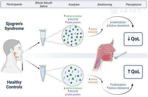 sjogren's syndrome tear test filter|sjogren's syndrome and saliva.